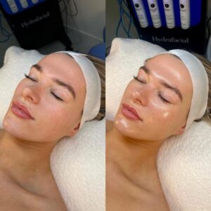 - Paris Parker Aveda Salons and Spas - Baton Rouge, New Orleans, Mandeville, LA Side-by-side photos of a woman lying on a Day Spa bed with her eyes closed before and after a facial treatment, showing clearer and more radiant skin in the after image. - Paris Parker Aveda Salons and Spas - Baton Rouge, New Orleans, Mandeville, LA